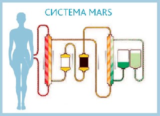 Cистема MARS